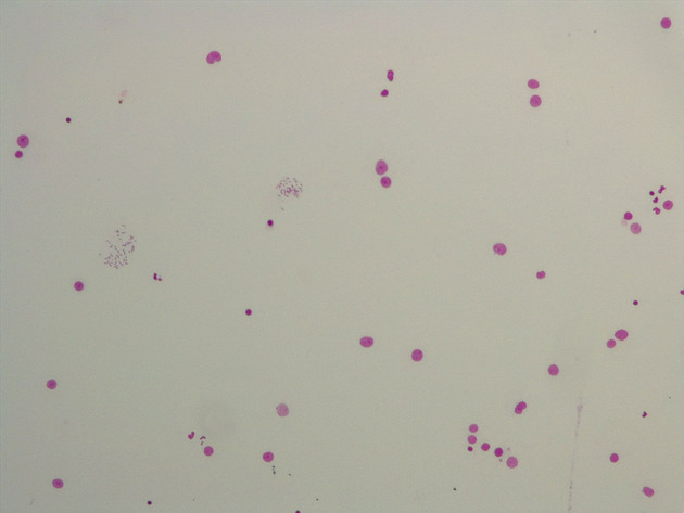Male Chromosomes Slides - Male Chromosomes 02 40X